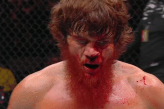 Shara Bullet Hospitalized in Abu Dhabi for Nose Surgery Following UFC Bout