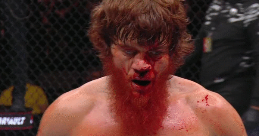 Shara Bullet Hospitalized in Abu Dhabi for Nose Surgery Following UFC Bout