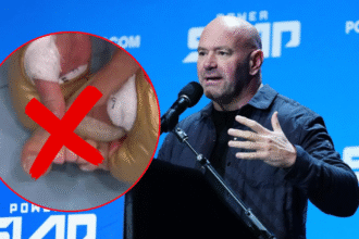 Did Alex Pereira Break His Toe in the UFC 320 Main Event? Dana White Reveals