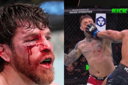 UFC Vet Jim Miller: The Sport Has Done Nothing About Eye Pokes, and It's Going to Cost Someone Their Vision