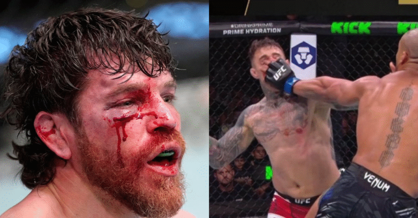 UFC Vet Jim Miller: The Sport Has Done Nothing About Eye Pokes, and It's Going to Cost Someone Their Vision