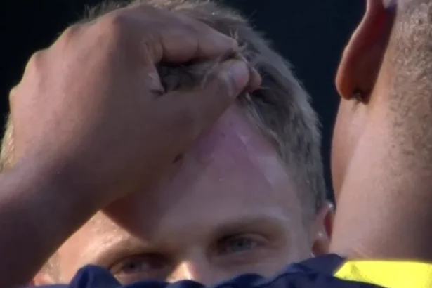 Ryan Rickelton suffers nasty head injury vs ZIM, doubtful for T20 World Cup 2026 semi-finals